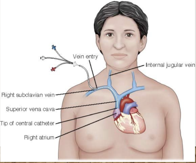 <p><mark data-color="#0eede2" style="background-color: rgb(14, 237, 226); color: inherit;">central venous pressure **on table</mark></p>