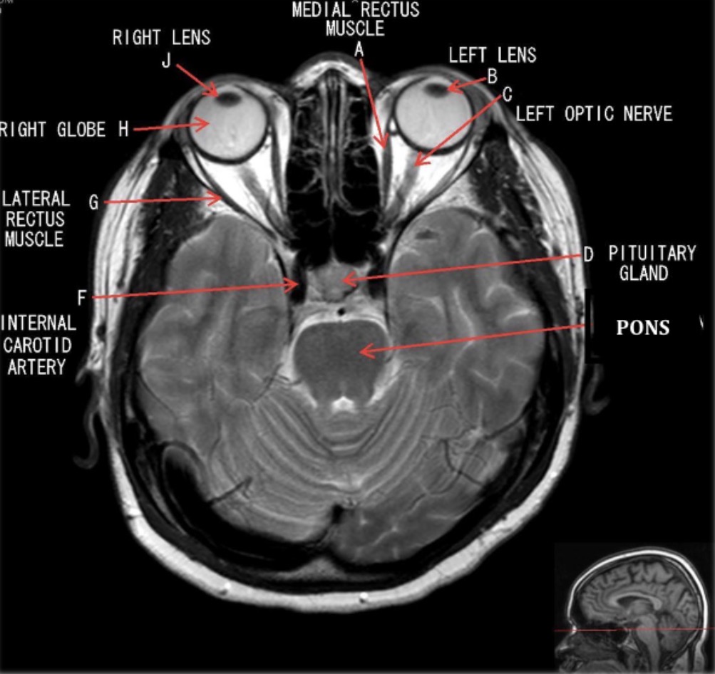 <p>What image is this?</p>