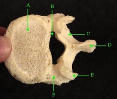 <p>E</p>