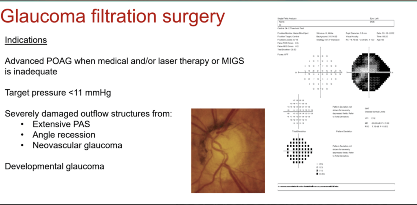 <p>Outflow structures can be severely damaged from what? These are reasons why a glaucoma filtration surgery may be indicated.</p>
