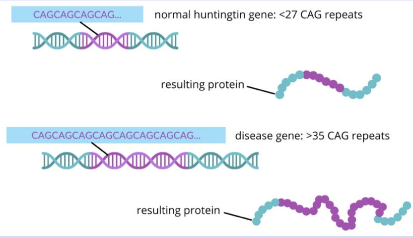 <p>Huntington’s is a progressive brain disorder that affects the central area of the brain.</p><p>Movement, mood and thinking skills are affected as a consequence.</p><ul><li><p>normally, CAG is repeated 10 to 35 times</p></li><li><p>With Huntington’s, it is repeated more than 120 times</p></li></ul><p></p>