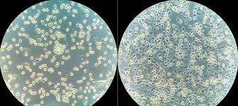 <p>Leukocytes </p>