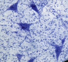 <p>- Cells in the nervous system that support, nourish, and protect neurons</p><p>*Smaller dots among neurons</p>