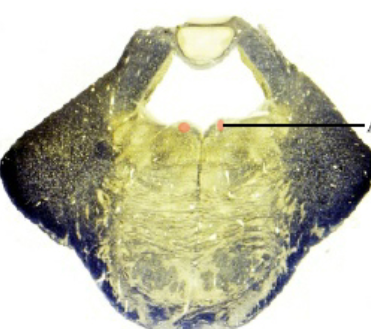 <p>A structure in the midbrain responsible for the control of motor functions of the abducens nerve.</p>