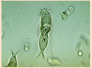 <p>Contain a flagella for movement</p><p>Hard protective outer coating</p><p>Free living, parasitic, or mutualistic</p><p>Ex. Trichonympha</p>