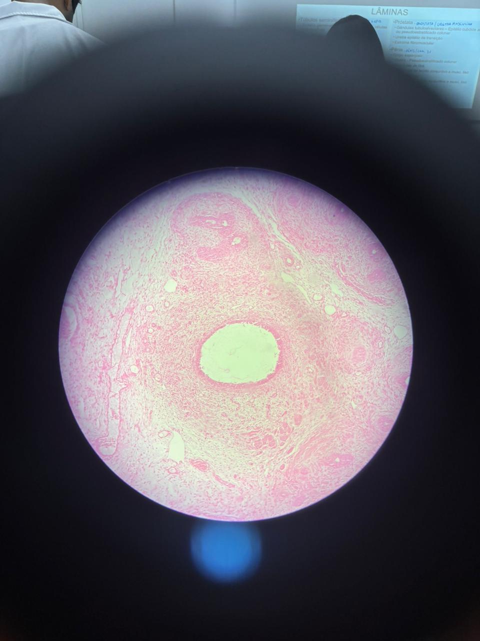 <p>Qual órgão é esse? cite uma caractéristica</p>