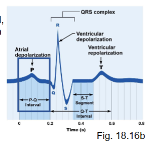<ul><li><p>atrial depolarization → followed by contraction</p></li></ul><p></p>