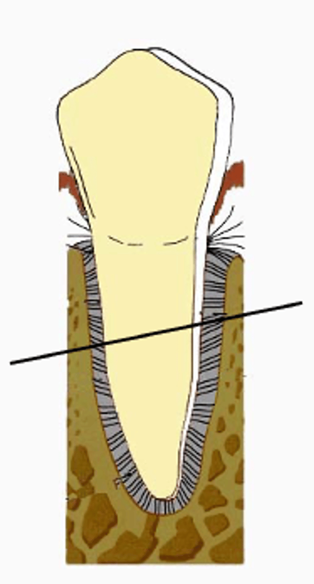 <p>What is movement of the tooth without the apex moving in the opposite direction?</p>