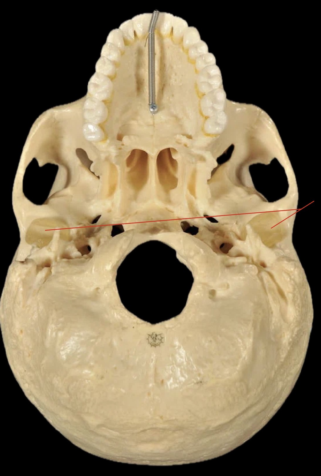 <p>What joint does this form?</p>