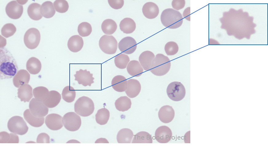 <p>echinocytes</p>
