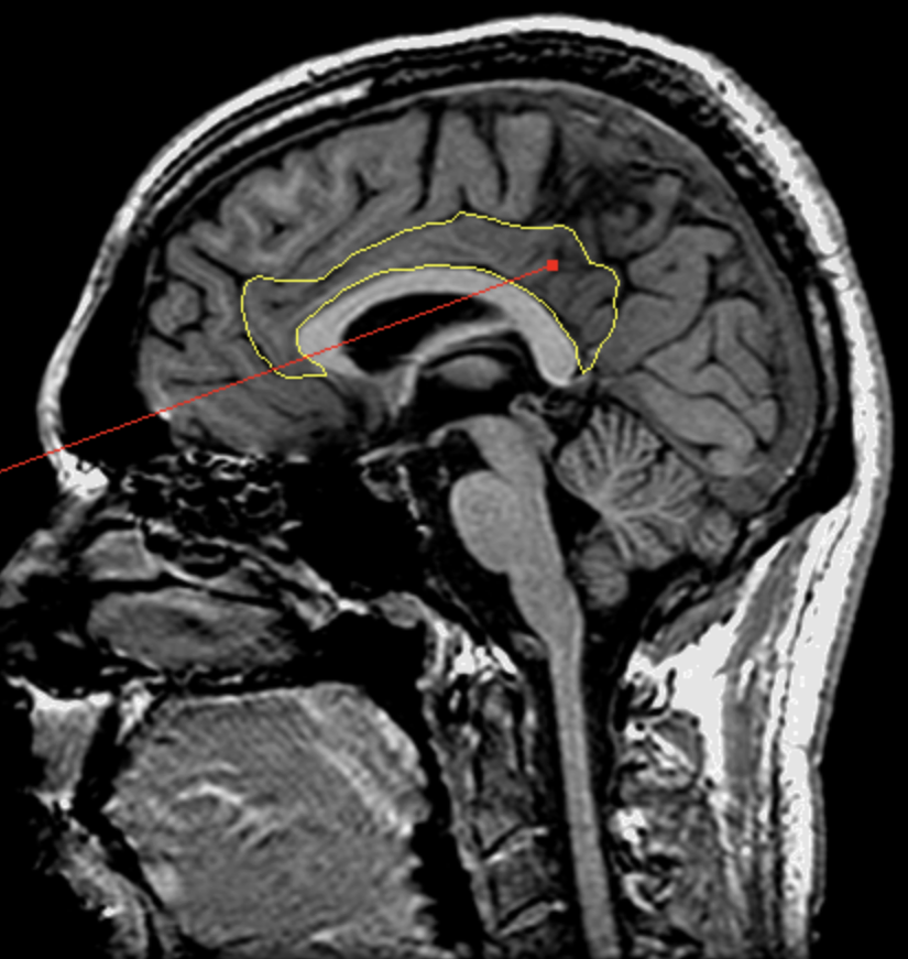 <p>What is the area highlighted called?</p>