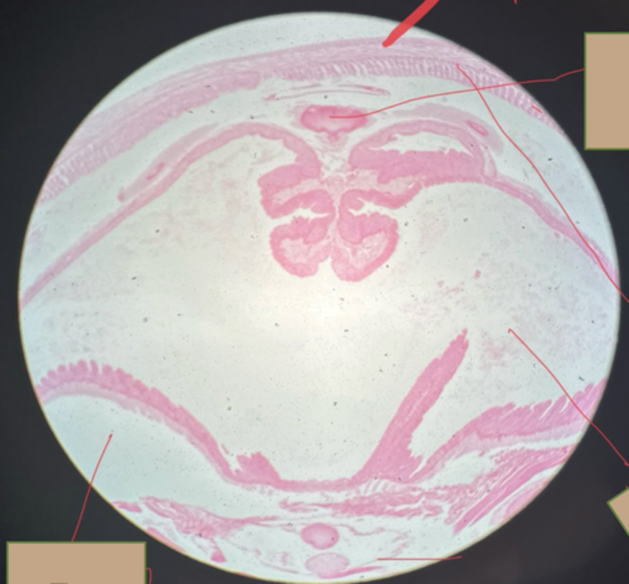 <p>subkingdom eumetaoza</p><p>phylum annelida</p><p>dorsal blood vessl, lumen, coelom, circular muscles, longitudinal muscles</p>