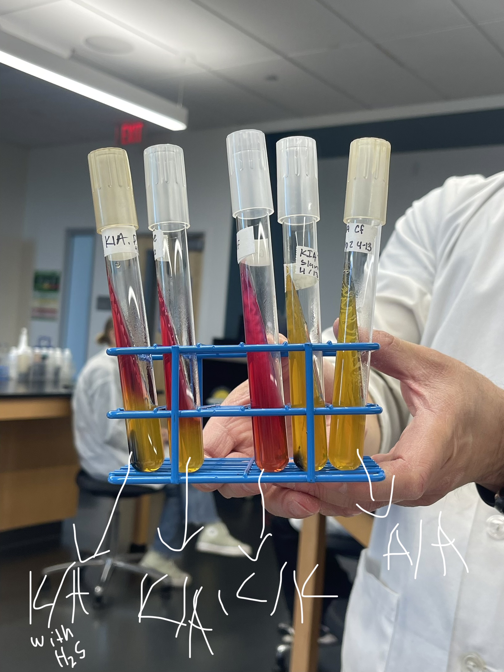<p><strong>Name: </strong>Kligler Iron Agar(KIA) Test</p><p><strong>PURPOSE: </strong>differential screening media based on: </p><ul><li><p>glucose fermentation</p></li><li><p>lactose fermenetation</p></li><li><p>H2S (hydrogen sulfide) production</p></li></ul><p><strong>APPLICATION: </strong>differentiate GNRs(gram(-) rods)</p><p><strong>MEDIA: </strong>Kligler Iron Agar Slant </p><ul><li><p><u>0.1% glucose:</u> fermentable sugar, low concentration (K/A) only glucose</p></li><li><p><u>1% lactose:</u> fermentable sugar, high concentration(yellow, yellow, K/K)</p></li><li><p><u>0.02% ferrous sulfate</u>: detects H2S —> <span style="color: rgb(255, 255, 255);"><mark data-color="#534444" style="background-color: rgb(83, 68, 68); color: inherit;">black color. </mark></span></p></li></ul><p><strong>MEDIA: </strong></p><ul><li><p><span style="color: rgb(225, 27, 27);">Phenol red:</span> pH indicator</p></li><li><p>Nutrient agar(slant)</p></li></ul><p><strong>INOCULATION GUIDE: </strong>loopful streak on slant surface, </p><ul><li><p>needle stab the butt(then remove)</p></li></ul><p><strong>INCUBATION: </strong>37°C for 48 hrs/</p><p><strong>THEORY AND RESULTS;</strong></p><ol><li><p><u>Ferments </u><strong><u>ONLY</u></strong><u> glucose: </u></p></li></ol><ul><li><p>Yellow butt: acid reacts with Phenol Red</p></li><li><p>Red Slant: after low concentration of glucose is used up, amino acid oxidation occurs —> produces ammonia(basic)</p></li></ul><ol start="2"><li><p><u>Ferments lactose </u><strong><u>OR </u></strong><u>lactose and glucose: </u></p></li></ol><ul><li><p>Yellow butt and slant: acid reacts with phenol red, so there is a high concentration of lactose.</p></li></ul><ol start="3"><li><p><u>Does </u><strong><u>NOT </u></strong><u>ferment either sugar:</u></p></li></ol><ul><li><p>Red or shocking pink butt and slant(so both red slant and butt, doesn’t produce any acid, so nothing should be yellow).</p></li></ul><p><strong>H2S Production: </strong></p><p>(+): black percipitant(like a black product)</p><ul><li><p>Gas production: </p></li></ul><p>(+): butt lift (like there is a lift in the medium)</p><p>Extra info:</p><ul><li><p>Break in yellow tube, ferments into acid as well as gas(no black = (-) for H2S)</p></li><li><p>black in bottom = H2S production</p></li><li><p>tube with red top, black middle, yellow bottom <strong>ONLY </strong>ferments glucose(+) for H2S production. </p></li></ul><p></p>