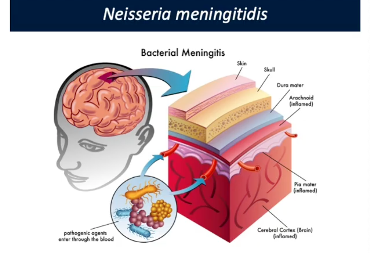 <p>Gram negative. Colonizes nasopharynx of individuals without causing disease. 5-15% of health adults. Rarely penetrates nasopharynx epithelial barrier reaching bloodstream</p><p>Once in bloodstream, grows and disseminates causing septicemia and meningitis (infection of brain)</p><p>Immune system does not have access to the brain because process is very toxic/deadly</p>