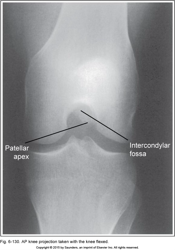 <p>AP knee</p>