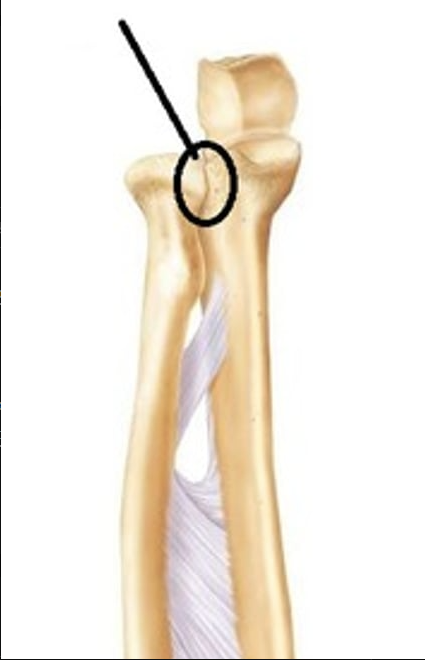 <p>What is this joint?</p>