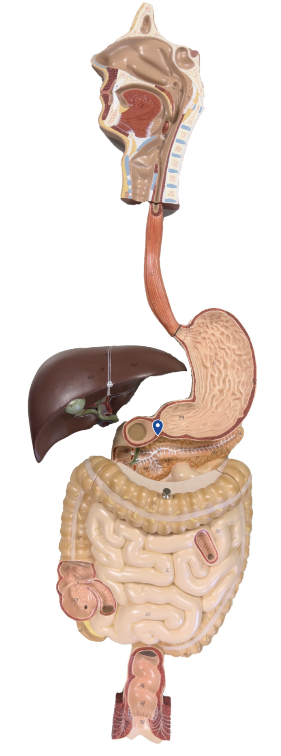 <p>Name this opening.</p>