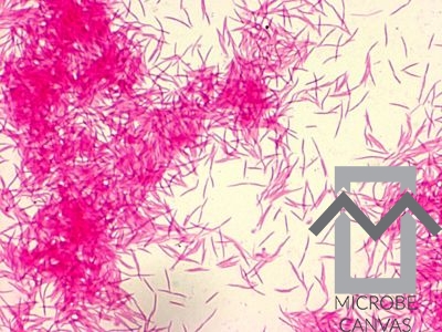 <p><em>Capnocytophaga</em></p>