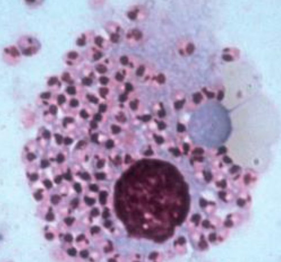 <p><span style="color: blue;">How is Leishmaniasis diagnosed? Treatment?</span></p>