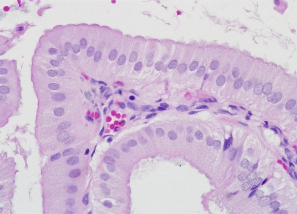 <p>storage and concentration of bile, comes from liver via Hepatic D, then leaves via common Bile D to SI</p><p>Abs w/ MV on simple columnar epit</p>