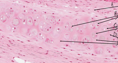 <p>What is indicated in by the arrow labeled 'A' in this slide of monkey trachea?</p>