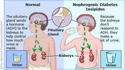 <p>Diabetes Insipidus</p><p>_____secretion of ____ </p>