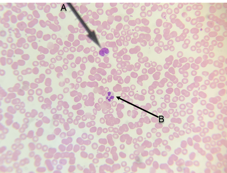 <p>In the image above, identify formed elements A and B.&nbsp;</p>