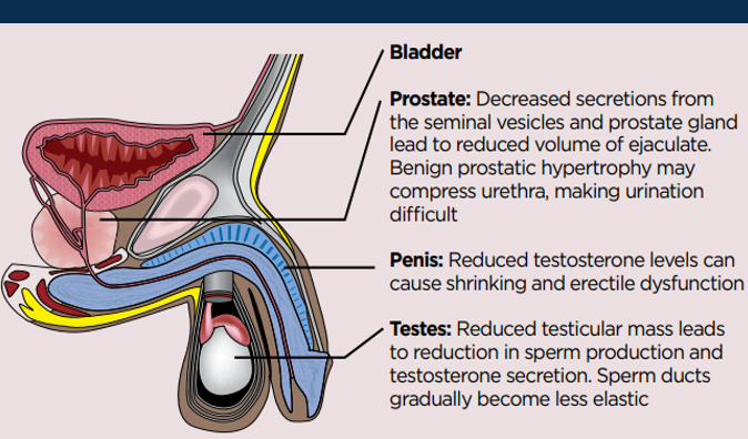 <p><span>•Some people experience difficult physical and psychological in mid-life – dubbed ‘andropause’. However, often multifactorial underlying causes related to life stressors and co-morbidities, rather than hormone deficiency.&nbsp;&nbsp;</span></p>