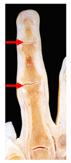 <p>hinge joint</p>