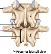 <p>Label the following:</p><ul><li><p>transverse process</p></li><li><p>body (centrum)</p></li><li><p>intervertebral disc</p></li><li><p>inferior articular process (L2 and L3)</p></li><li><p>Lamina</p></li></ul><p></p>