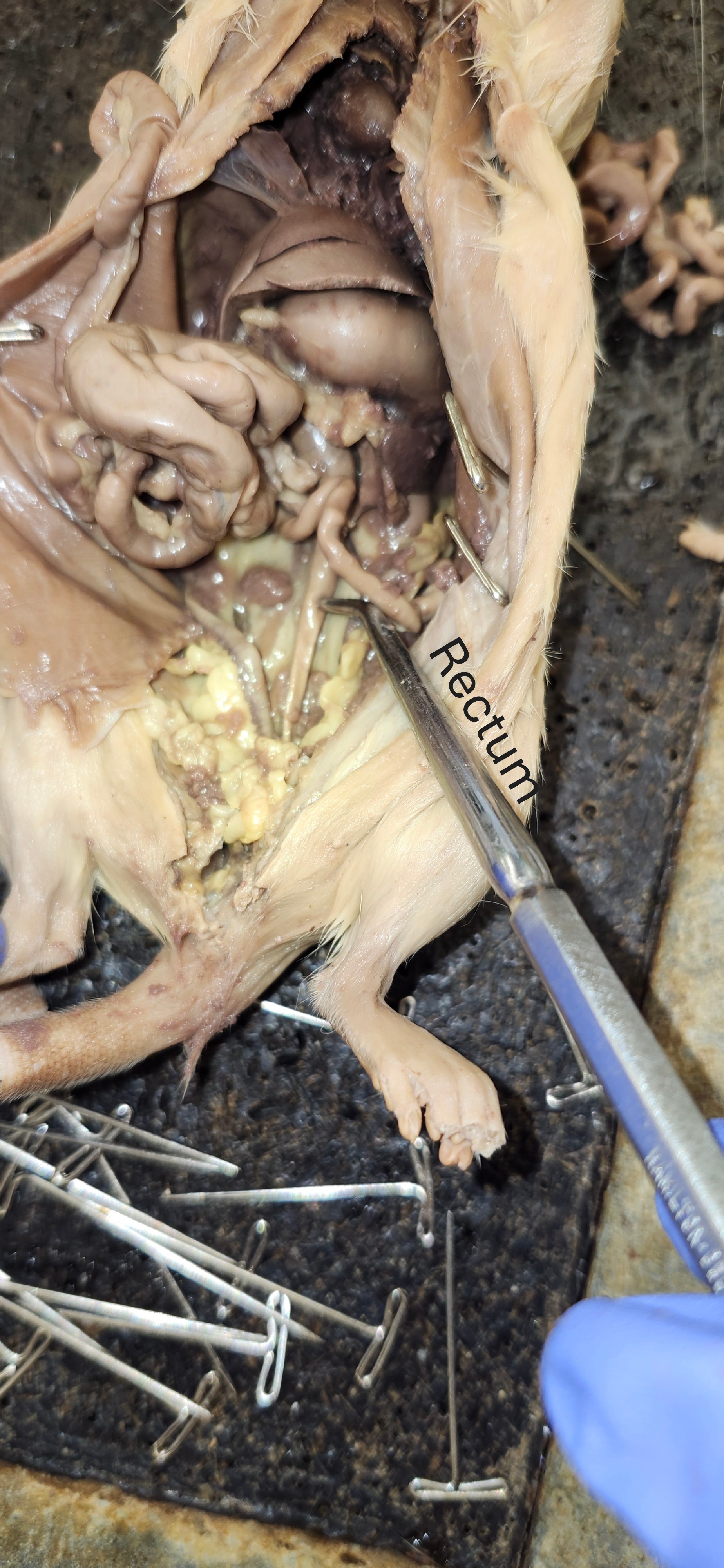 <p>rectum</p>