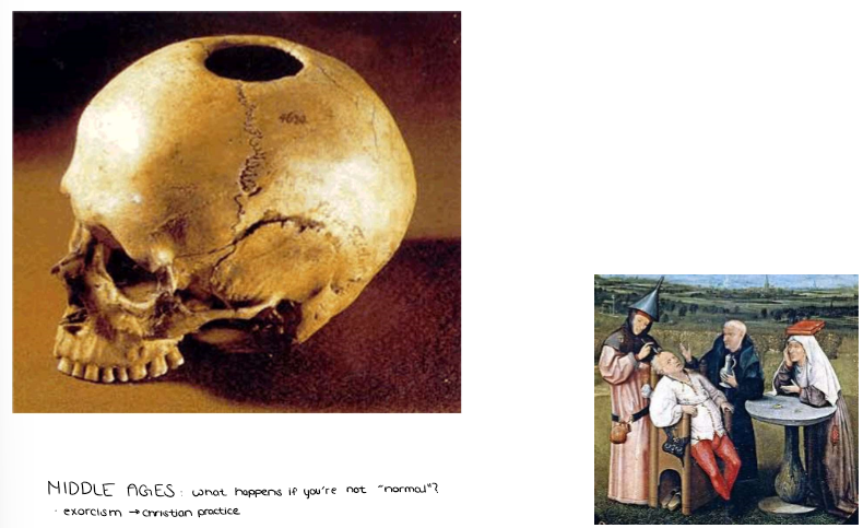 <p>(Unit 5B - Part 1 - Psychological Disorders) <strong>Historical Views of Psychological Disorders</strong></p><ul><li><p>Explain the history of the MIDDLE AGES. What happens if you’re not “normal”?</p></li></ul><p></p>