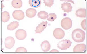 <p>what type of inclusion is this?</p>