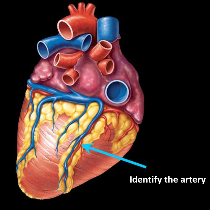 <p>Identify the artery?</p>