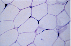 <p>Identify the type of connective tissue</p>
