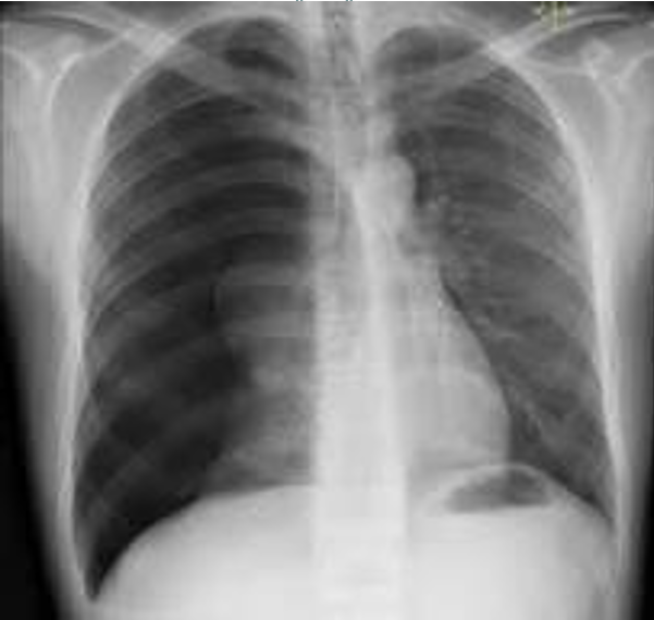 <p>Diagnosis</p>