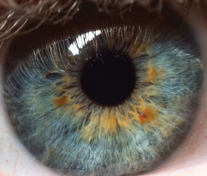 term image