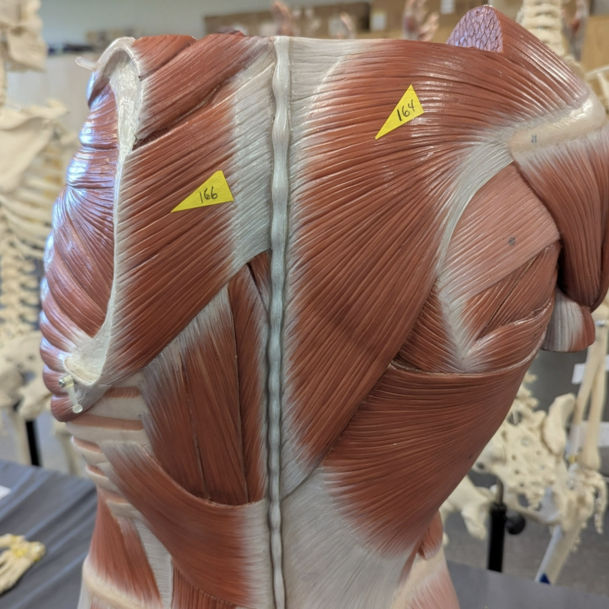 <p>Where is the trapezius and rhomboideus and what are their actions </p>