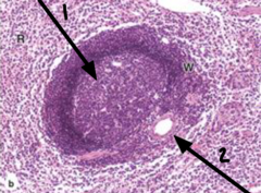 <p>What is arrow 2 pointing to in the spleen?</p>