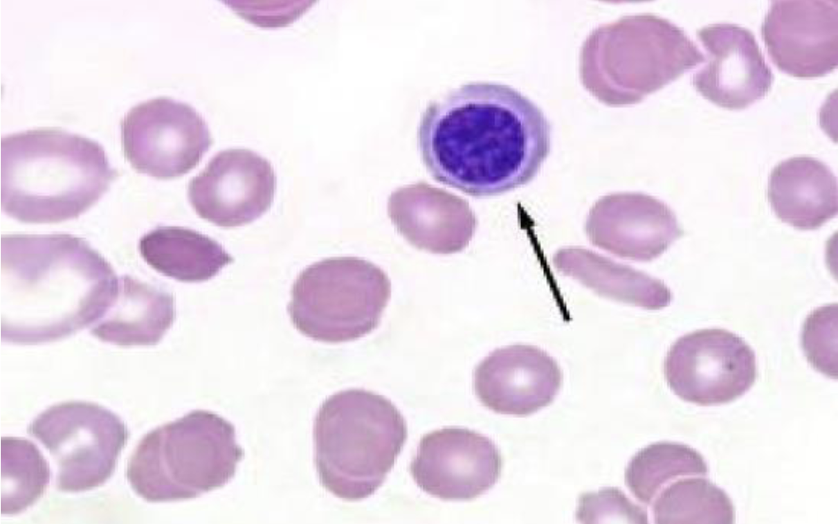 <p>Nucleated Red Blood Cell </p>