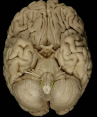 <p>what cranial nerve is the highlighted section</p>