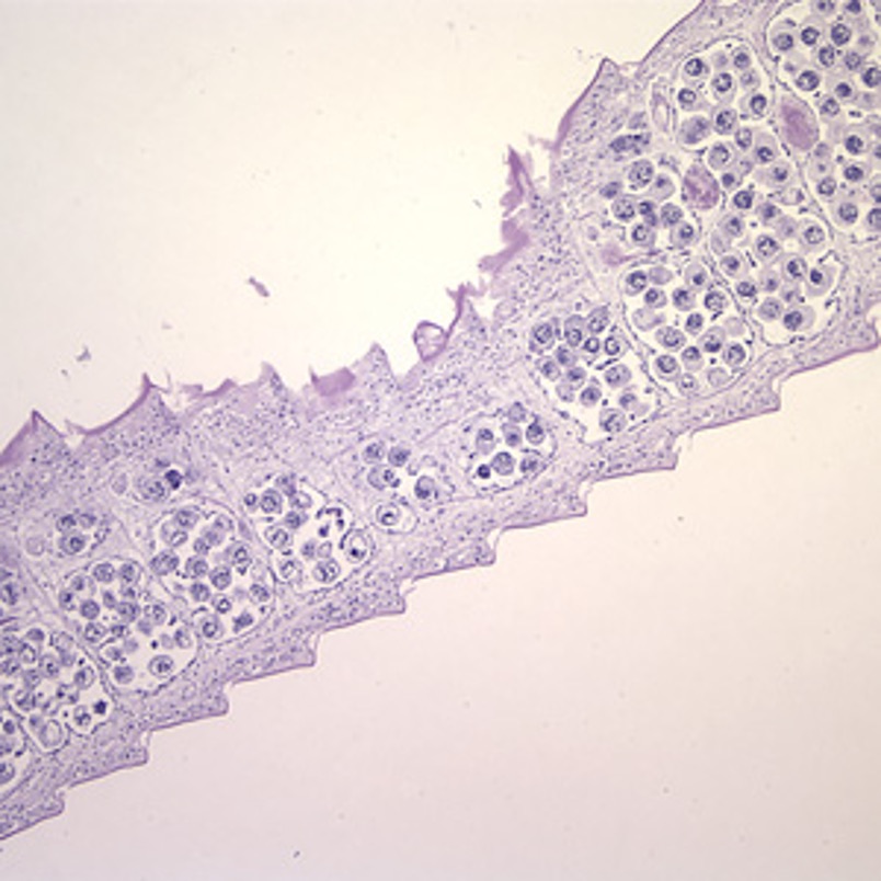 term image