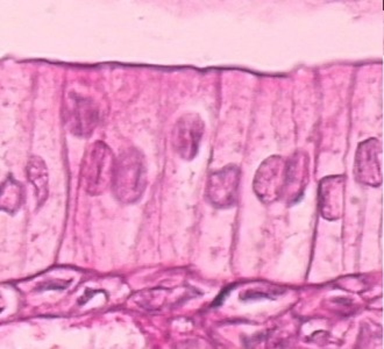 <p>type of cell present?</p>
