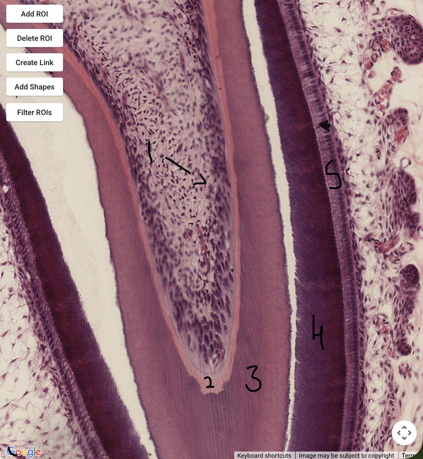 term image
