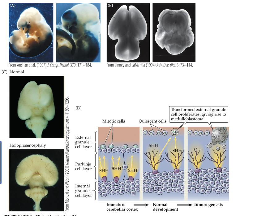 <p><span style="font-family: "Calibri Light";"><strong>Inductive Signals and Neurodevelopmental Disorders</strong></span></p>