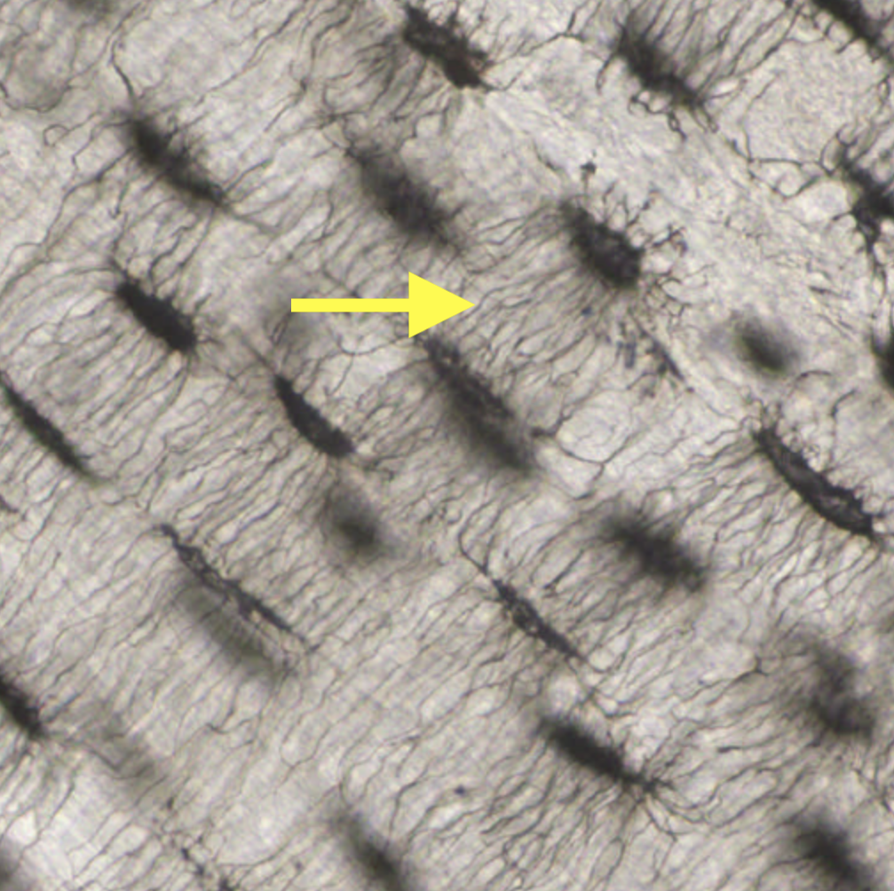 <p>Name the type of cell seen in this slide image</p>
