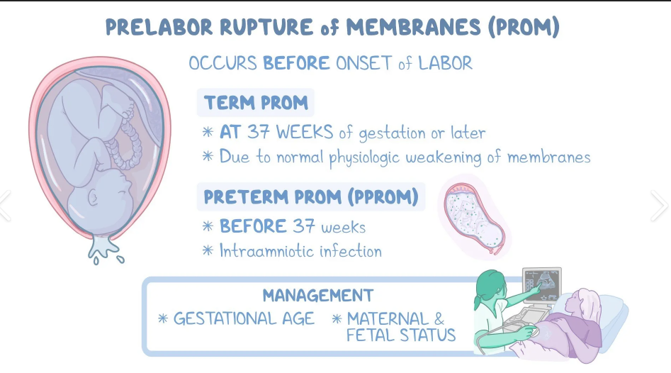<p><strong>Prelabor-ROM</strong>: rupture of membrane <span style="color: rgb(250, 97, 97);"><strong>b4 labor</strong> begins @ <strong>term (> 37 weeks)</strong></span></p><p><strong>PPROM</strong>: <span style="color: rgb(44, 120, 166);"><strong>b4 labor and b4 37</strong></span> weeks (< 37 weeks)</p>