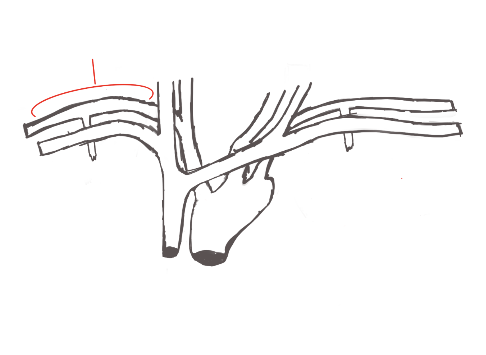 <p>structure. Goes along clavical</p>