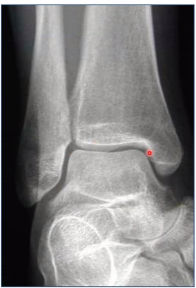 <p>What is being shown in this x-ray</p>