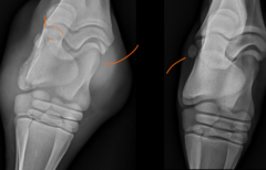 <p>What are the signs of septic arthritis seen here? (hint, they ARE outlined by my crappy orange annotations)</p>